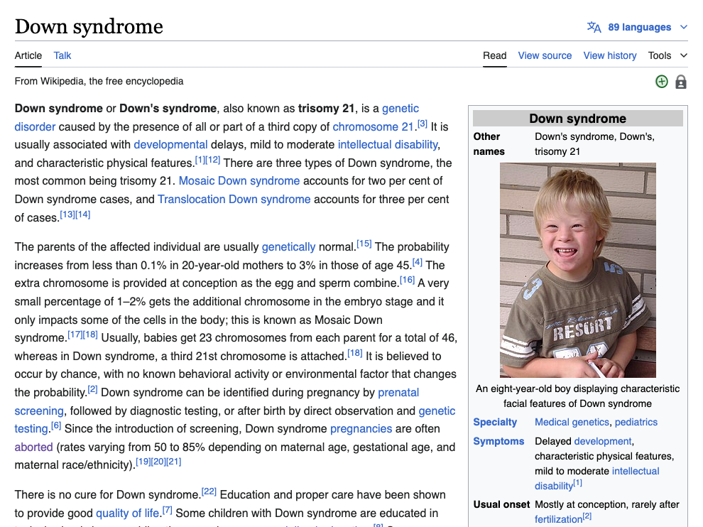 Screenshot of Down syndrome article on Wikipedia