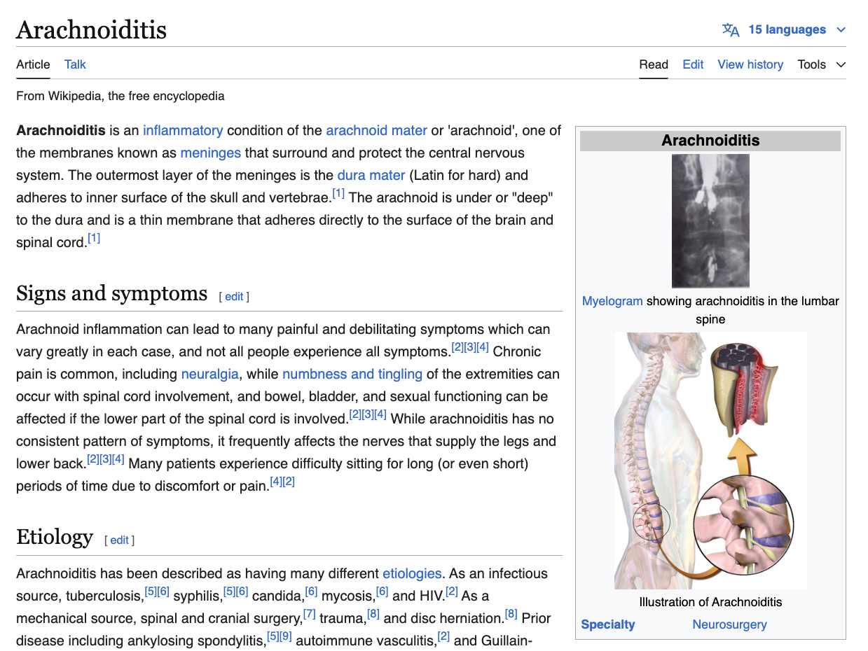 Screenshot of Arachnoiditis Wikipedia article